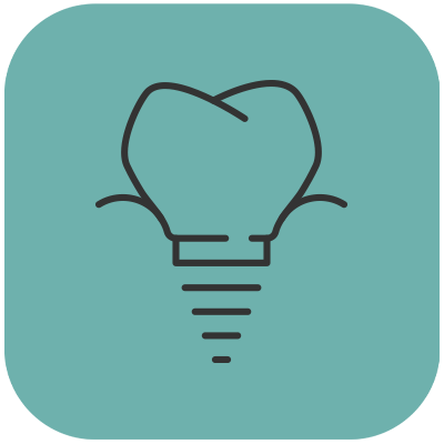dental implant