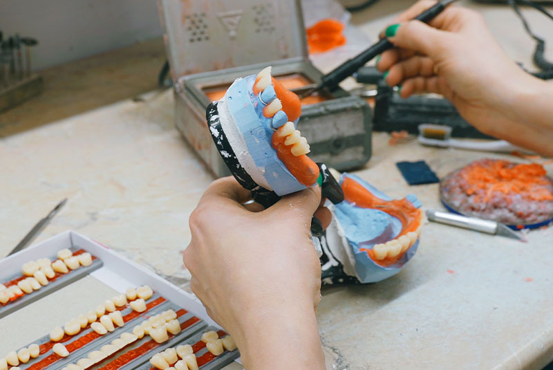 dentures being made