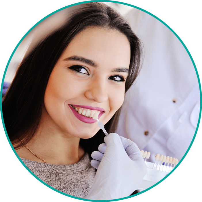 Veneers