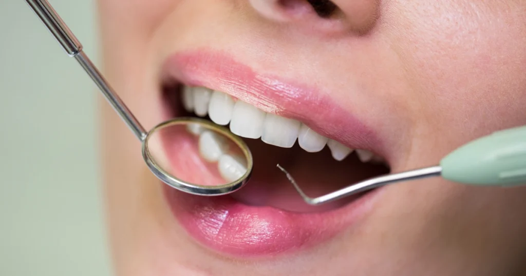 patient recovering from dental bone graft with the help of exo dental caring team